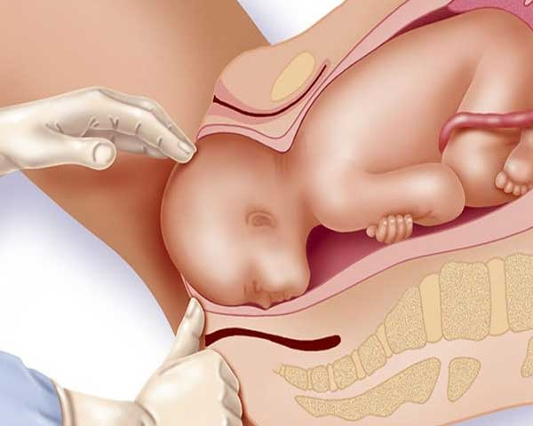 Normal Delivery vs C-Section: Benefits & Best Gynaecologist in Kolkata 5 download 2